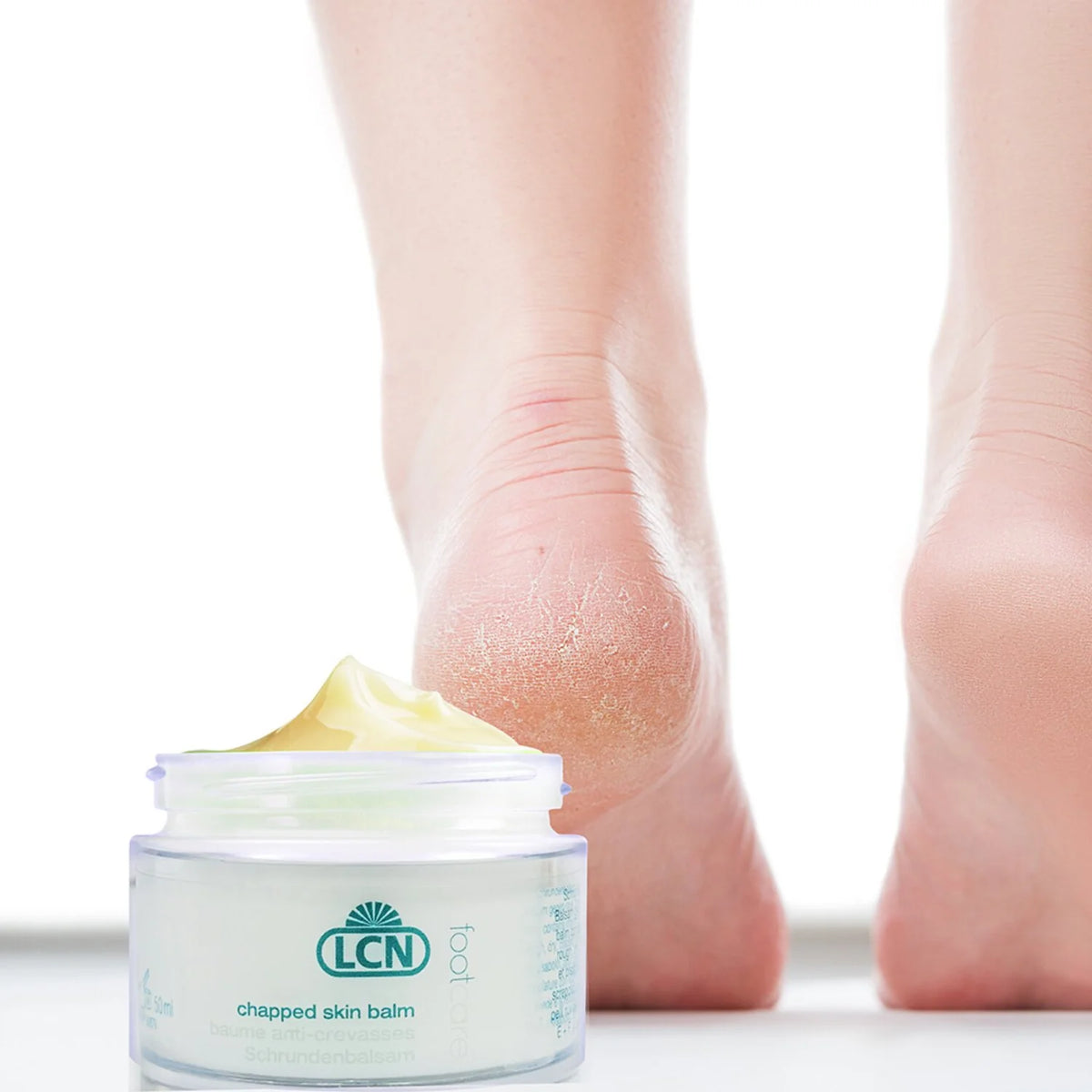 Chapped Skin Balm Y276